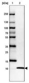 Ubiquitin Fold Modifier 1 antibody, NBP1-88977, Novus Biologicals, Western Blot image 
