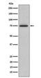 Abl Interactor 2 antibody, M04302, Boster Biological Technology, Western Blot image 