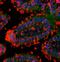 Colony Stimulating Factor 2 Receptor Alpha Subunit antibody, GTX37684, GeneTex, Immunohistochemistry paraffin image 