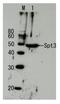 Protein SPT3 antibody, GTX64168, GeneTex, Western Blot image 