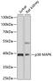 Mitogen-Activated Protein Kinase 13 antibody, 19-708, ProSci, Western Blot image 