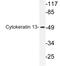 Keratin 13 antibody, LS-C177566, Lifespan Biosciences, Western Blot image 