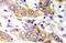 Kinase Insert Domain Receptor antibody, AP20909PU-N, Origene, Immunohistochemistry frozen image 