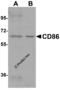 CD86 antibody, 8681, ProSci, Western Blot image 