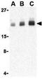 Peptidyl-TRNA Hydrolase 2 antibody, GTX85497, GeneTex, Western Blot image 