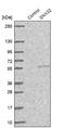 Sorting Nexin 32 antibody, NBP1-92424, Novus Biologicals, Western Blot image 