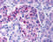 Inhibitor Of Nuclear Factor Kappa B Kinase Subunit Epsilon antibody, 2329, ProSci, Immunohistochemistry paraffin image 