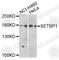 SET Binding Protein 1 antibody, A7212, ABclonal Technology, Western Blot image 