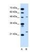 Neutral sphingomyelinase antibody, NBP1-59937, Novus Biologicals, Western Blot image 