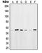 POU Class 2 Homeobox 2 antibody, orb214420, Biorbyt, Western Blot image 