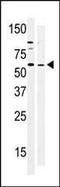 Protein Tyrosine Kinase 6 antibody, PA5-14787, Invitrogen Antibodies, Western Blot image 