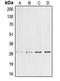 Cyclin G1 antibody, LS-C351943, Lifespan Biosciences, Western Blot image 
