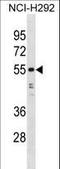 Heterogeneous Nuclear Ribonucleoprotein H1 antibody, LS-C157814, Lifespan Biosciences, Western Blot image 