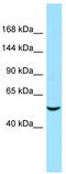 Rho Guanine Nucleotide Exchange Factor 40 antibody, TA343243, Origene, Western Blot image 