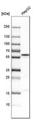 Golgi Associated PDZ And Coiled-Coil Motif Containing antibody, HPA024018, Atlas Antibodies, Western Blot image 