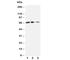 C-X3-C Motif Chemokine Ligand 1 antibody, R30472, NSJ Bioreagents, Western Blot image 