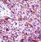 Keratin, type II cytoskeletal 6C antibody, LS-C165633, Lifespan Biosciences, Immunohistochemistry frozen image 