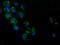 Hydroxyacid Oxidase 1 antibody, TA501959, Origene, Immunofluorescence image 