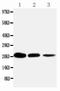 TNF Receptor Superfamily Member 1A antibody, PA1418, Boster Biological Technology, Western Blot image 