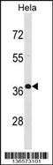 Poly(A) Binding Protein Nuclear 1 antibody, 58-751, ProSci, Western Blot image 