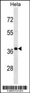 Pabp2 antibody, 58-751, ProSci, Western Blot image 