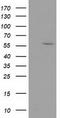Dystrobrevin Alpha antibody, LS-C337204, Lifespan Biosciences, Western Blot image 