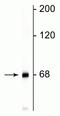 Neurofilament Light antibody, A02482, Boster Biological Technology, Western Blot image 
