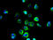 Solute Carrier Family 39 Member 11 antibody, A61006-100, Epigentek, Immunofluorescence image 