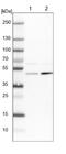 Adenylosuccinate Synthase antibody, NBP1-90360, Novus Biologicals, Western Blot image 