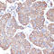 Keratin 18 antibody, LS-C746770, Lifespan Biosciences, Immunohistochemistry paraffin image 