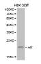 Adenylate Kinase 1 antibody, LS-C192480, Lifespan Biosciences, Western Blot image 