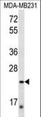 Peroxisomal Biogenesis Factor 11 Alpha antibody, LS-C158573, Lifespan Biosciences, Western Blot image 