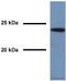 RAB7A, Member RAS Oncogene Family antibody, ab50533, Abcam, Western Blot image 