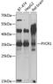Pyrroline-5-Carboxylate Reductase 1 antibody, 14-935, ProSci, Western Blot image 