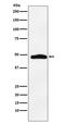 MAPK Activated Protein Kinase 2 antibody, M01193-2, Boster Biological Technology, Western Blot image 