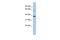 RALY Heterogeneous Nuclear Ribonucleoprotein antibody, GTX47713, GeneTex, Western Blot image 