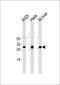 Caudal Type Homeobox 1 antibody, MA5-18113, Invitrogen Antibodies, Western Blot image 
