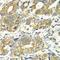 Dihydrolipoamide S-Succinyltransferase antibody, A6901, ABclonal Technology, Immunohistochemistry paraffin image 