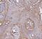 Integrin Subunit Alpha V antibody, M01561-2, Boster Biological Technology, Immunohistochemistry paraffin image 