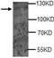 Adenylate Cyclase 2 antibody, TA310096, Origene, Western Blot image 
