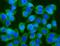 Glutamine--Fructose-6-Phosphate Transaminase 1 antibody, A04341-1, Boster Biological Technology, Immunofluorescence image 