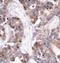 Stathmin 1 antibody, STJ22421, St John