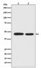 Mitogen-Activated Protein Kinase Kinase 1 antibody, M00292-2, Boster Biological Technology, Western Blot image 