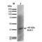 Potassium Voltage-Gated Channel Subfamily J Member 8 antibody, LS-C773808, Lifespan Biosciences, Western Blot image 