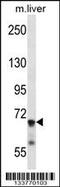 Interleukin 1 Receptor Type 1 antibody, 57-404, ProSci, Western Blot image 