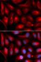Proteasome Subunit Alpha 5 antibody, LS-B13392, Lifespan Biosciences, Immunofluorescence image 