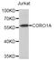 Coronin 1A antibody, LS-C410834, Lifespan Biosciences, Western Blot image 