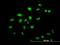 Zinc Finger Protein 136 antibody, H00007695-M03, Novus Biologicals, Immunofluorescence image 