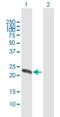 Zinc Finger CCHC-Type Containing 4 antibody, H00029063-B01P, Novus Biologicals, Western Blot image 