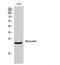 Recoverin antibody, STJ95402, St John